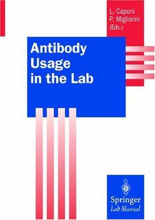 Antibody usage in the lab