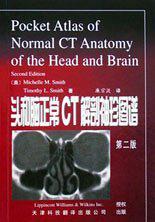 头和脑正常CT解剖袖珍图谱 第二版