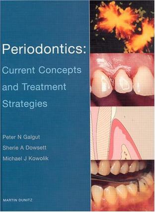 Periodontics current concepts and treatment strategies