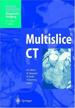 Multislice CT