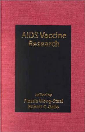 AIDS vaccine research