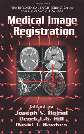 Medical image registration