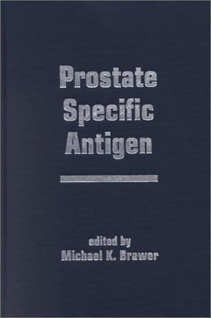 Prostate specific antigen