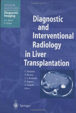 Diagnostic and interventional radiology in liver transplantation