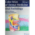 Oral pathology