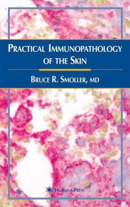 Practical immunopathology of the skin