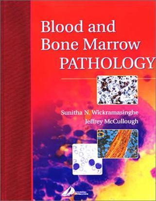 Blood and bone marrow pathology