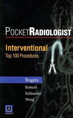 袖珍放射专家 干涉介入的100个主要诊断