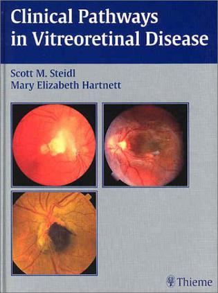 Clinical pathways in vitreoretinal disease