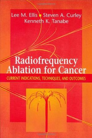 Radiofrequency ablation for cancer current indications, techniques, and outcomes