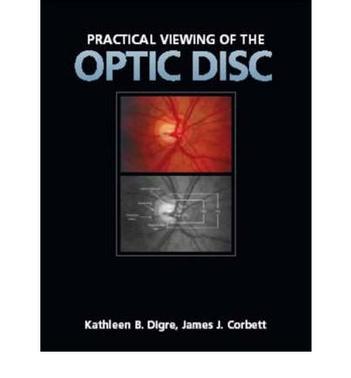 Practical viewing of the optic disc