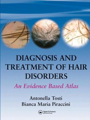 Diagnosis and treatment of hair disorders an evidence based atlas