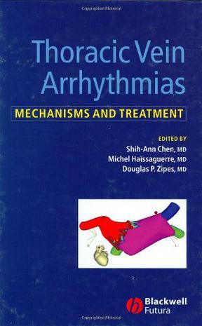 Thoracic vein arrhythmias mechanisms and treatment