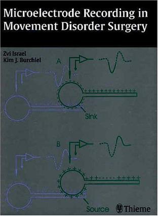 Microelectrode recording in movement disorder surgery