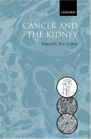 Cancer and the kidney