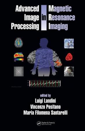 Advanced image processing in magnetic resonance imaging