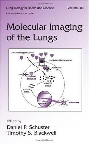 Molecular imaging of the lungs