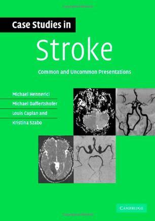 Case studies in stroke common and uncommon presentations