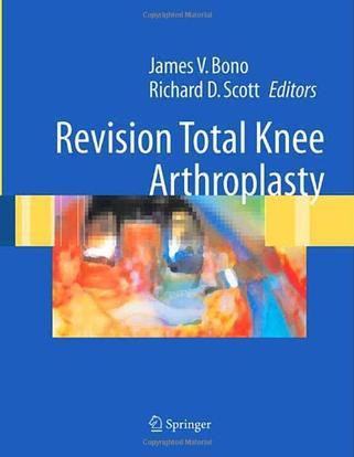 Revision total knee arthroplasty