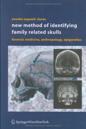New method of identifying family related skulls forensic medicine, anthropology, epigenetics