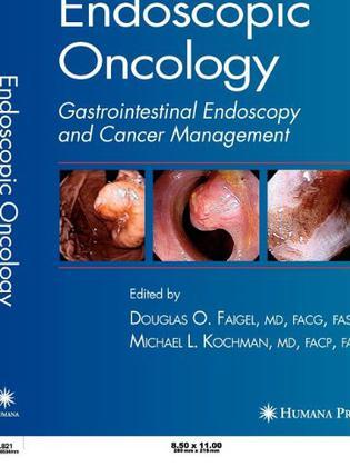 Endoscopic oncology gastrointestinal endoscopy and cancer management