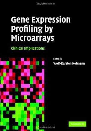 Gene expression profiling by microarrays clinical implications