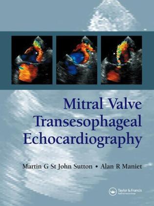 Mitral valve transesophageal echocardiography