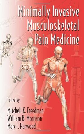 Minimally invasive musculoskeletal pain medicine
