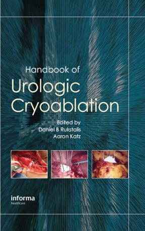 Handbook of urologic cryoablation