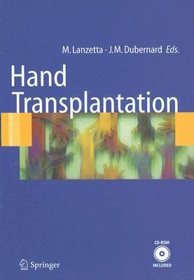 Hand transplantation