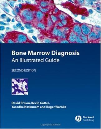 Bone marrow diagnosis an illustrated guide