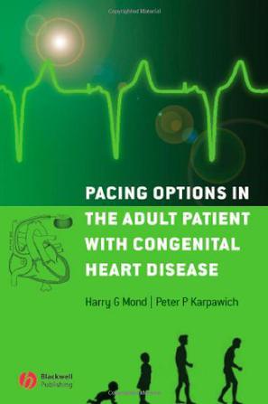 Pacing options in the adult patient with congenital heart disease