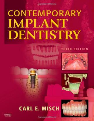 Contemporary implant dentistry