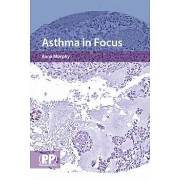 Asthma in focus