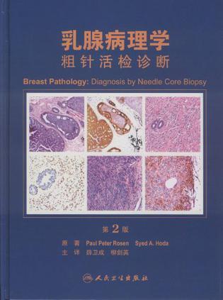 乳腺病理学 粗针活检诊断 diagnosis by needle core biopsy