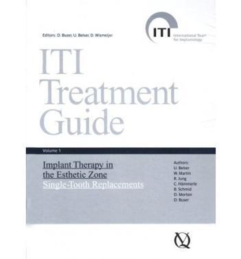 Implant therapy in the esthetic zone single-tooth replacements
