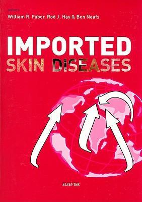 Imported skin diseases