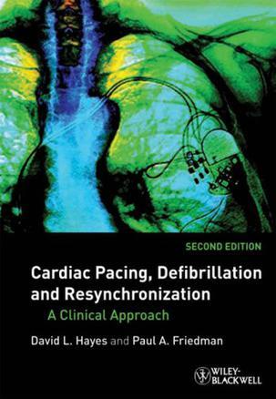 Cardiac pacing, defibrillation and resynchronization a clinical approach