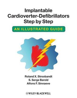 Implantable cardioverter-defibrillators step by step an illustrated guide