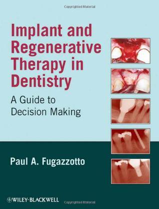 Implant and regenerative therapy in dentistry a guide to decision making