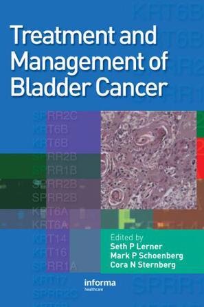 Treatment and management of bladder cancer