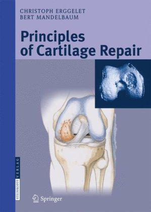 Principles of cartilage repair