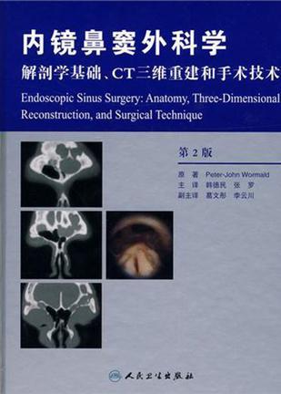 内镜鼻窦外科学 解剖学基础、CT三维重建和手术技术 anatomy, three-dimensional reconstruction and surgical technique