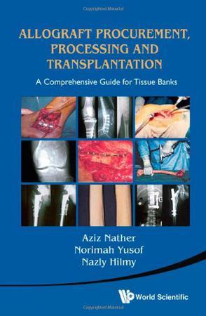 Allograft procurement, processing and transplantation a comprehensive guide for tissue banks