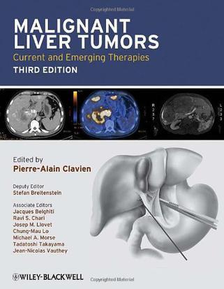 Malignant liver tumors current and emerging therapies