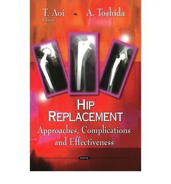 Hip replacement approaches, complications and effectiveness