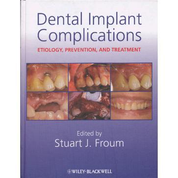 Dental implant complications etiology, prevention, and treatment