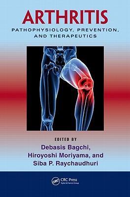 Arthritis pathophysiology, prevention, and therapeutics