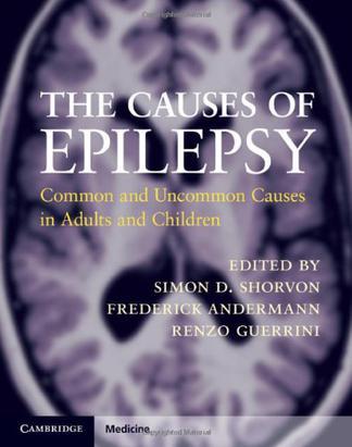 The causes of epilepsy common and uncommon causes in adults and children