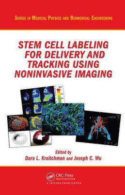 Stem cell labeling for delivery and tracking using noninvasive imaging